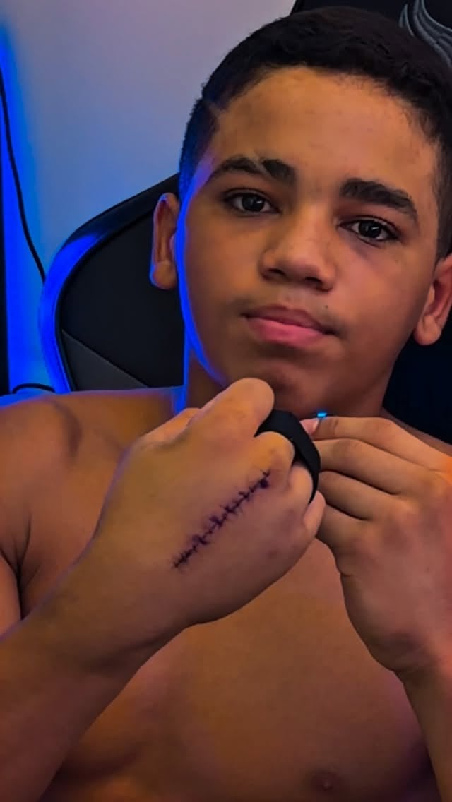 Uma fratura.Uma cirurgia.Uma placa.7 parafusos.E uma nova batalha começou.Infelizmente o TCB fica pelo caminho em 2026… e podem acreditar, isso dói.Dói porque atleta sonha, treina e vive por esses momentos.Mas às vezes a vida nos obriga a parar… não pra desistir… mas pra reconstruir.Agora é recuperação, fisioterapia, disciplina e fé.Uma batalha de cada vez.Porque atleta pode até parar por um momento…Mas desistir nunca foi opção by @cacauzinho_neto